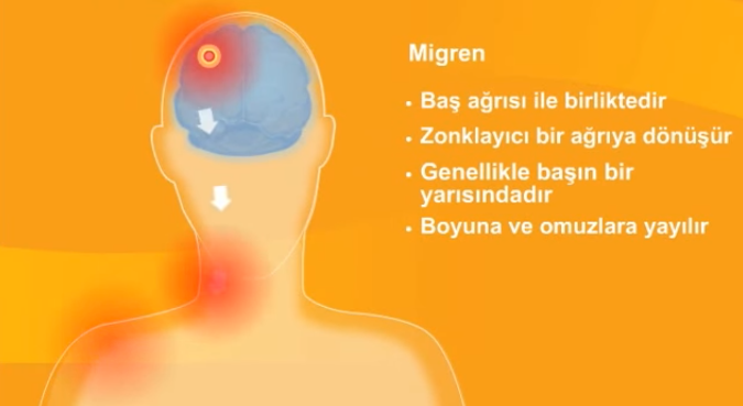 migren-asisi-ile-migren-tedavisi