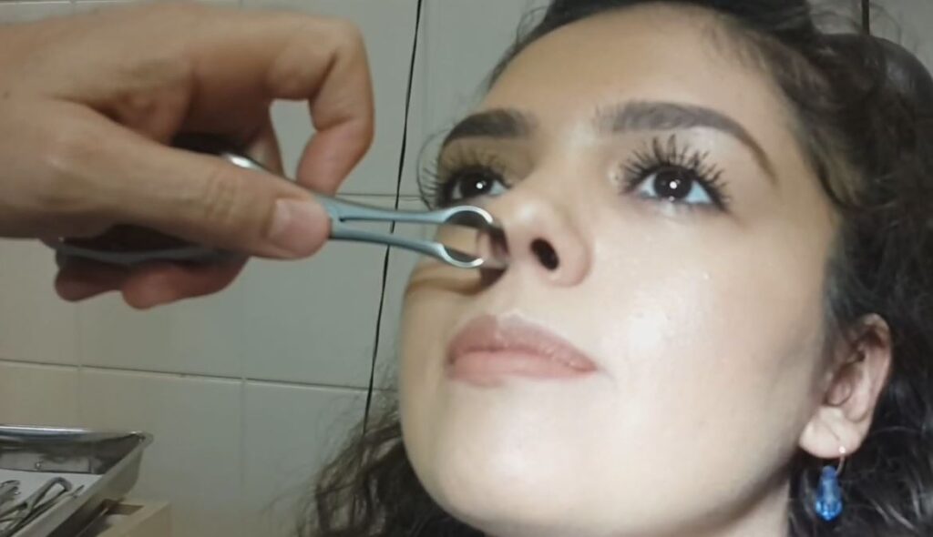 Türkiye’nin En İyi KBB Doktorları Listesi 2023/2024